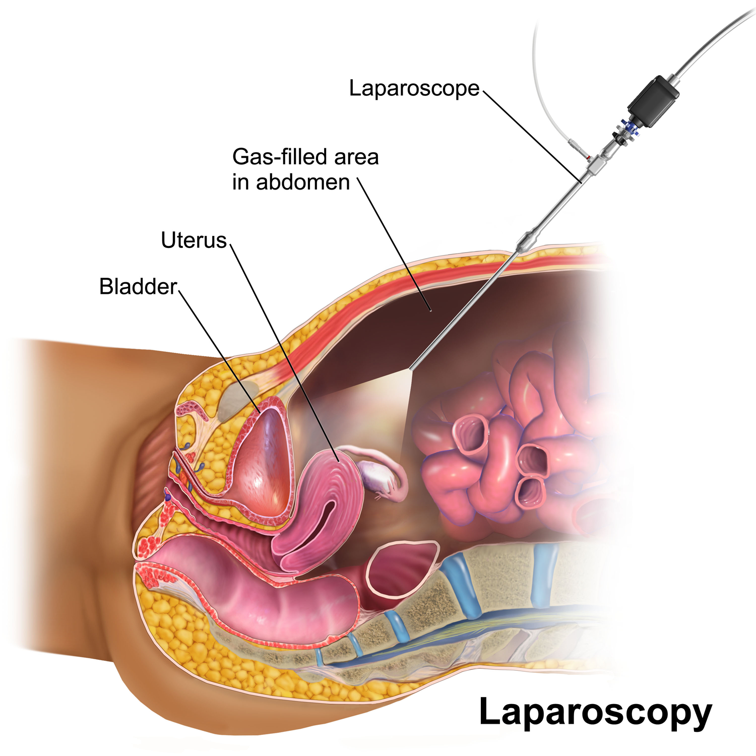 3D Laparoscopic Operating Theatre Setup and Patient Positioning