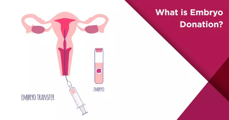 What is Embryo Donation Diagram